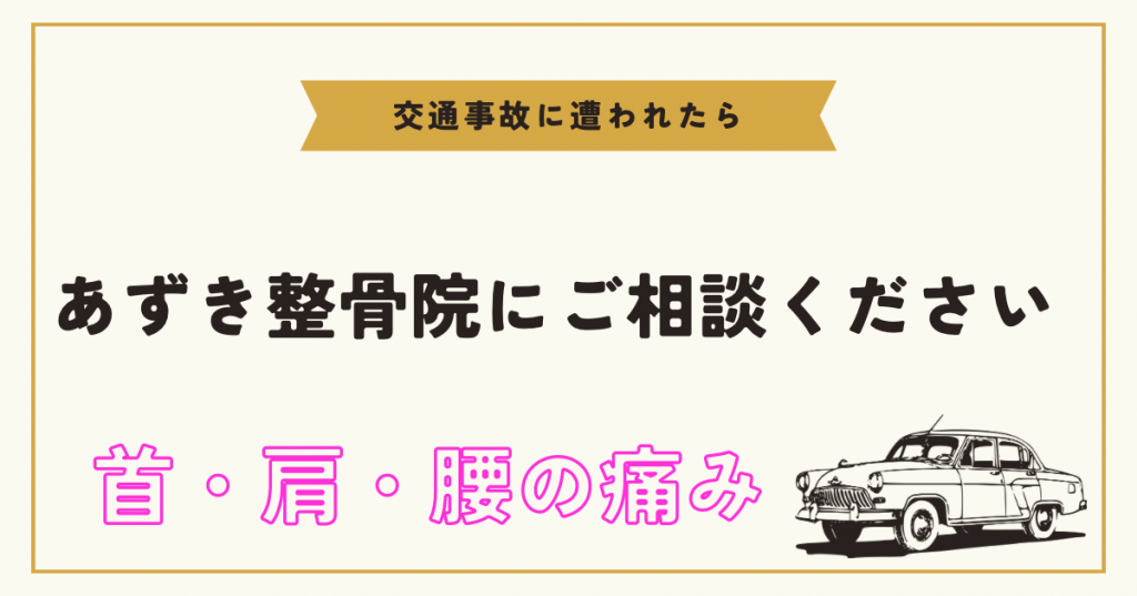 黄色　白　シンプル　レトロ　車の選び方　おすすめの車種　はてなブログ　ブログ　アイキャッチ画像